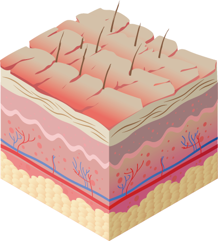 Imagen vectorial de piel con efectos de cal a nivel hidratación sin usar el monomando OPTIMAL 360º de Hidrosalud