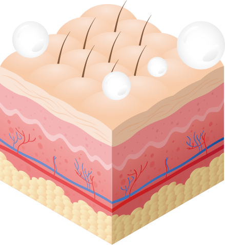 Imagen vectorial de piel sin efectos de cal usando el monomando OPTIMAL 360º de Hidrosalud